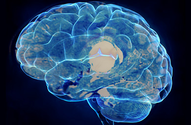 Solution neurologie