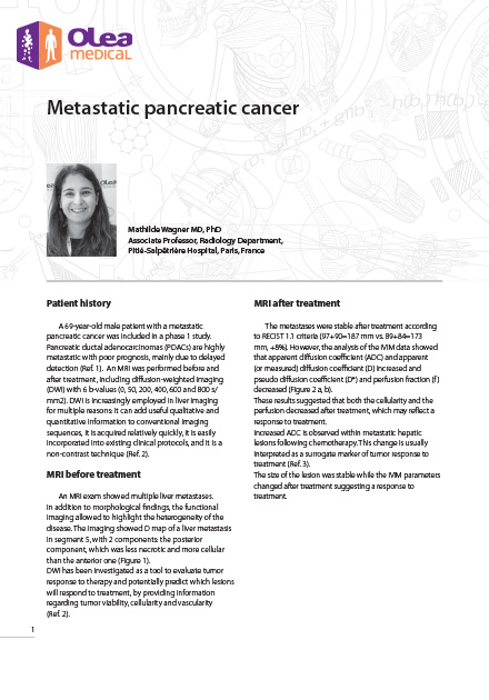 Olea case report: Metastatic Pancreatic Cancer