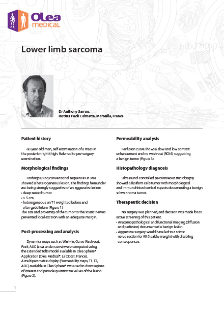 Lower Limb Sarcoma