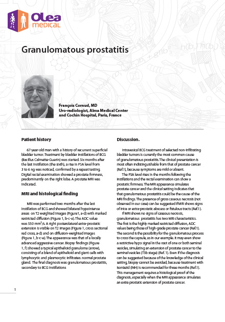 Granulomatous Prostatitis