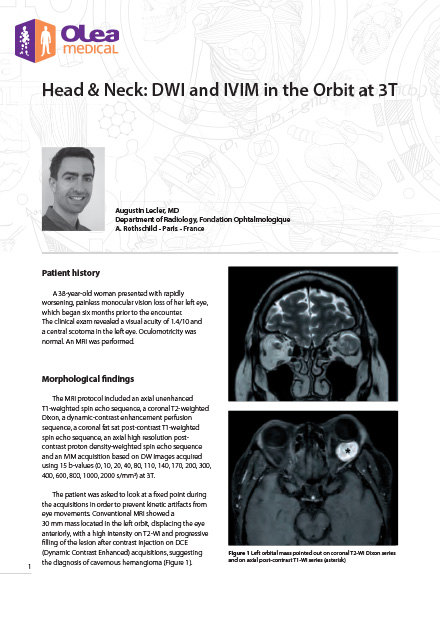 Head & Neck: DWI and IVIM in the Orbit at 3T