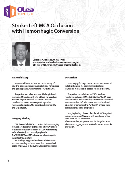 Olea case report: Stroke: Left MCA Occlusion with Hemorrhagic Conversion