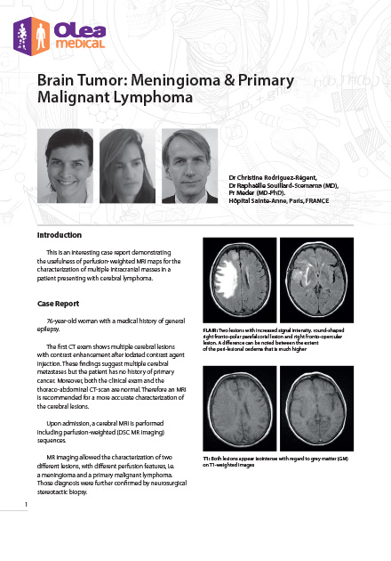 Brain Tumor: Meningioma & Primary Malignant Lymphoma