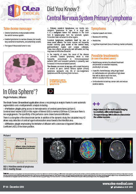 Central Nervous System Primary Lymphoma