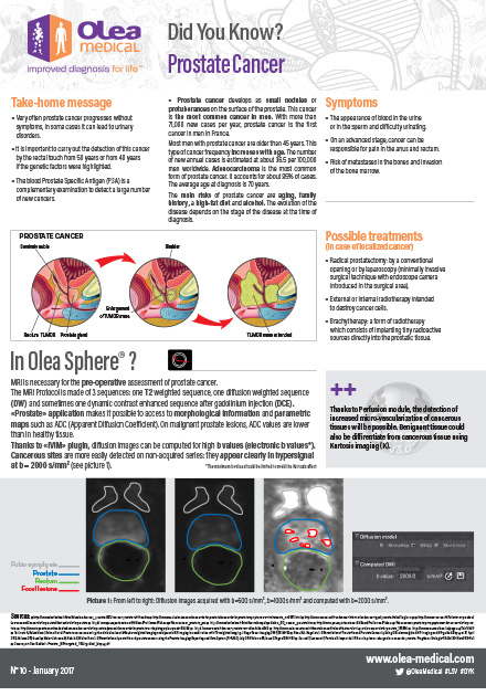 Prostate Cancer