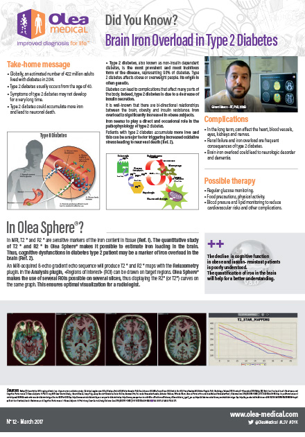 Brain Iron Overload in Type 2 Diabetes