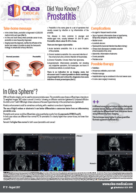 Prostatitis