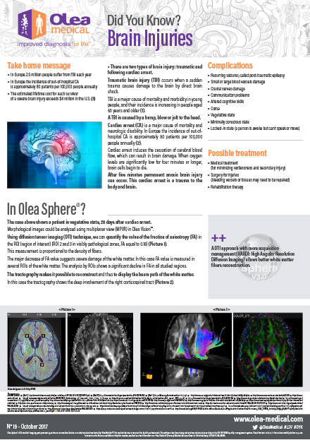 Brain Injuries