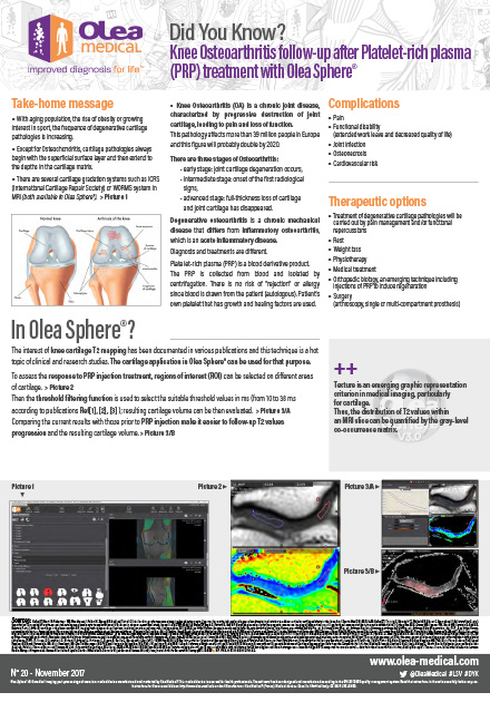 Knee Osteoarthritis Follow-Up After Platelet-Rich Plasma Treatment