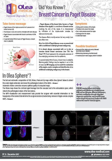 Breast Cancer in Paget Disease