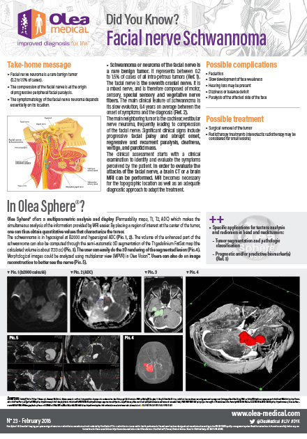 Facial Nerve Schwannoma