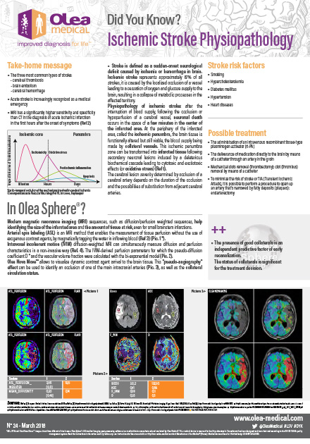 Ischemic Stroke Physiopathology