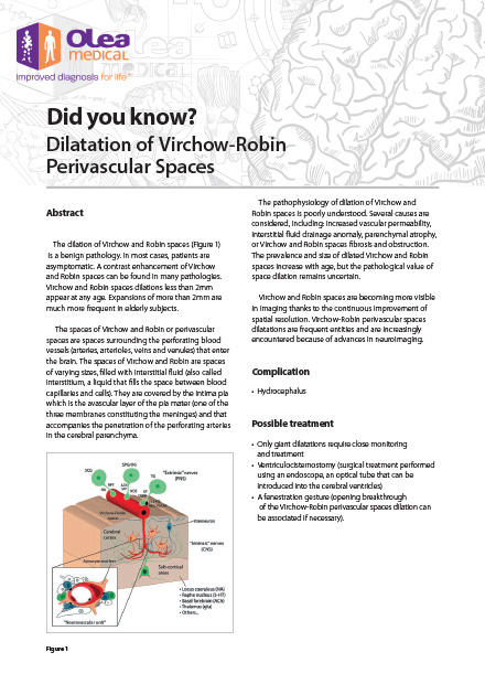 Dilatation of Virchow-Robin Perivascular Spaces