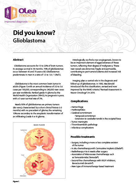 Glioblastoma