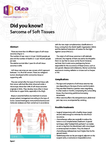 Sarcoma of Soft Tissues
