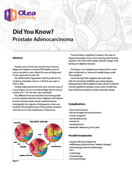 Prostate Adenocarcinoma