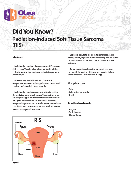 Radiation-Induced Soft Tissue Sarcoma