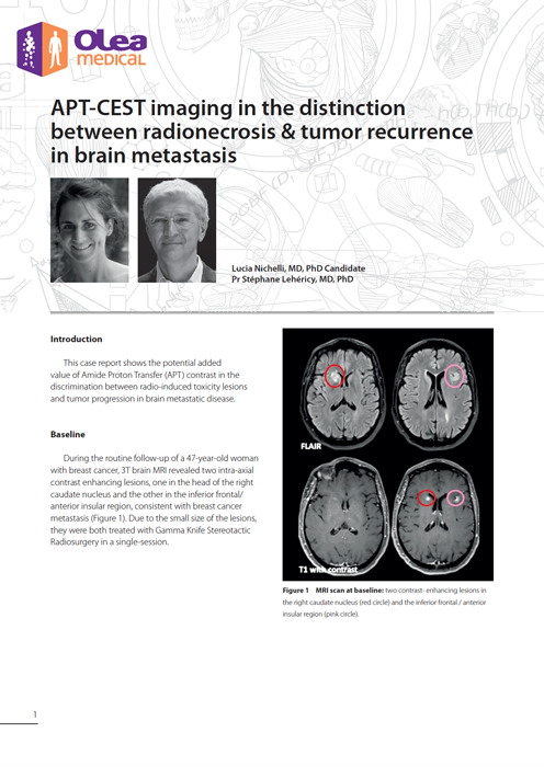 Olea case report: APT-CEST imaging in the distinction between radionecrosis & tumor recurrence in brain metastasis