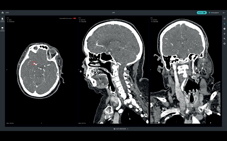 MRI image