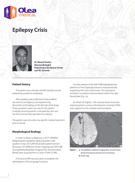 Olea case report: Epilepsy Crisis
