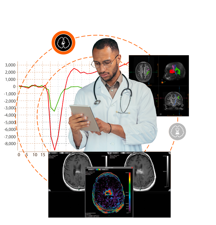 Solution imagerie en neurologie