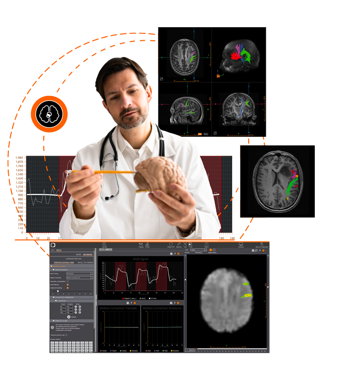 Solution IRM fonctionnelle fMRI