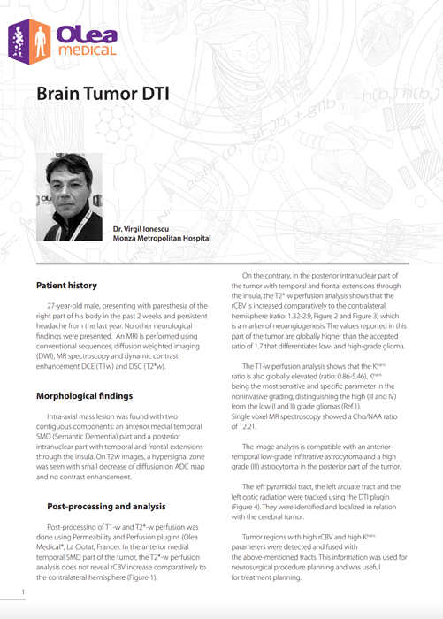 Olea case report: Brain Tumor DTI